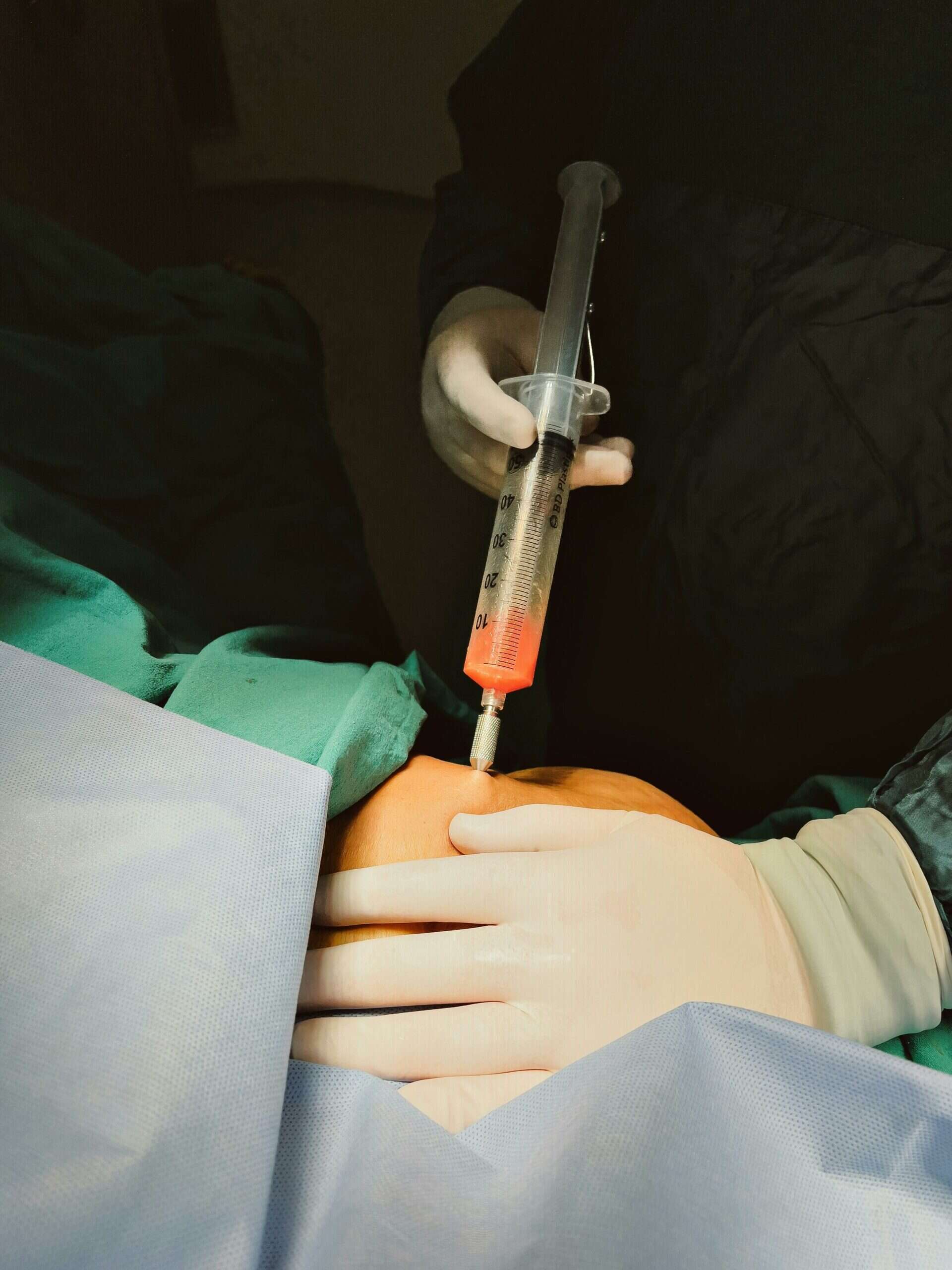 Fedtsugning-operation